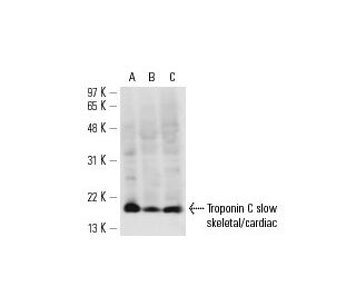 Troponin C slow skeletal/cardiac Antibody (12G3) - Western Blotting - Image 13618 