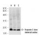 Troponin C slow skeletal/cardiac Antibody (12G3) - Western Blotting - Image 13618 