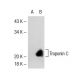 Troponin C slow skeletal/cardiac Antibody (12G3) - Western Blotting - Image 32420