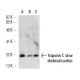 Troponin C slow skeletal/cardiac Antibody (1A2) - Western Blotting - Image 13617 