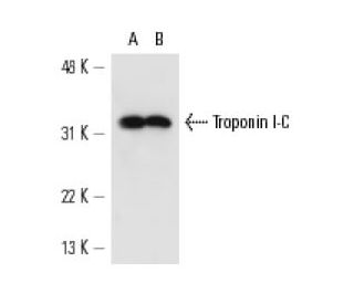 Troponin I-C Antibody (10B11) - Western Blotting - Image 13724