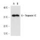 Troponin I-C Antibody (10B11) - Western Blotting - Image 13724