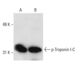 p-Troponin I-C Antibody (5E6) - Western Blotting - Image 13863