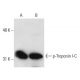 p-Troponin I-C Antibody (5E6) - Western Blotting - Image 13863