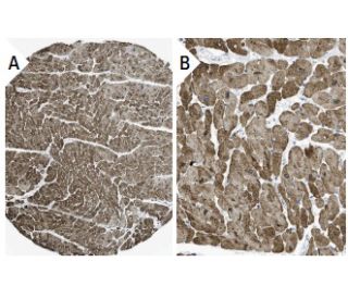 Troponin I-C Antibody (C5) - Immunohistochemistry - Image 37676 