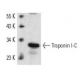 Troponin I-C Antibody (C5) - Western Blotting - Image 10678