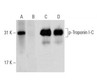 Troponin I-C Antibody (M46) - Western Blotting - Image 135384 