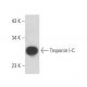 Troponin I-C Antibody (TPC-14) - Western Blotting - Image 15868