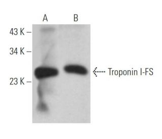 Troponin I-FS Antibody (H-4) - Western Blotting - Image 365604 