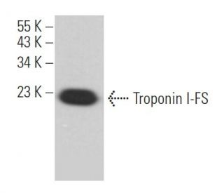 Troponin I-FS Antibody (G-7) - Western Blotting - Image 365605