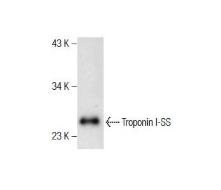 Troponin I-SS Antibody (G-11) - Western Blotting - Image 158951 