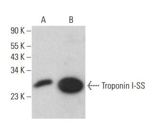 Troponin I-SS Antibody (C-4) - Western Blotting - Image 382361Each CRISPR/Cas9 Knockout (KO) Plasmid product consists of a pool of 3 plasmids designed to ensure identification and cleavage of a specific gene for maximum knockout efficiency. Each plasmid encodes a unique 20 nt sequence derived from the GeCKO (v2) library. 