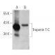 Troponin T-C Antibody (A-11) - Western Blotting - Image 372271 