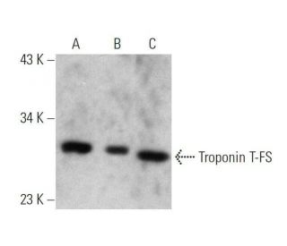 Troponin T-FS Antibody (B-4) - Western Blotting - Image 358583 