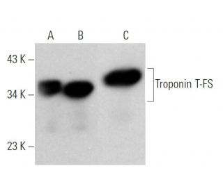 Troponin T-FS Antibody (H-8) - Western Blotting - Image 374682Each CRISPR/Cas9 Knockout (KO) Plasmid product consists of a pool of 3 plasmids designed to ensure identification and cleavage of a specific gene for maximum knockout efficiency. Each plasmid encodes a unique 20 nt sequence derived from the GeCKO (v2) library.