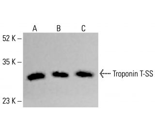 Troponin T-SS Antibody (A-8) - Western Blotting - Image 414076 