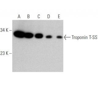 Troponin T-SS Antibody (A-9) - Western Blotting - Image 359951 