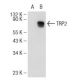 TRP2/DCT Antibody (D-8) - Western Blotting - Image 108892