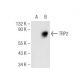TRP2/DCT Antibody (F-9) - Western Blotting - Image 93680 