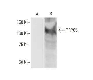 TRPC5 Antibody (1C8) - Western Blotting - Image 347583 