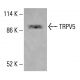 TRPV5-Antikörper (B-8): sc-398345. Western Blot Analyse der TRPV5 Expression in HCT-116-Gesamtzelllysat. Verwendetes Nachweisreagenz: m-IgG Fc BP-HRP: sc-525409. TRPV5 Antibody (B-8) - Western Blotting - Image 415446