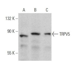 TRPV5 Antibody (B-6) - Western Blotting - Image 359927Each CRISPR/Cas9 Knockout (KO) Plasmid product consists of a pool of 3 plasmids designed to ensure identification and cleavage of a specific gene for maximum knockout efficiency. Each plasmid encodes a unique 20 nt sequence derived from the GeCKO (v2) library.