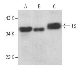 TS Antibody (F-7) - Western Blotting - Image 356118 