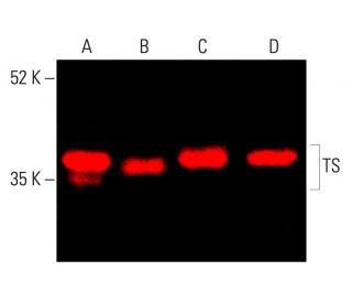 TS Antibody (TS 106) - Western Blotting - Image 402102 
