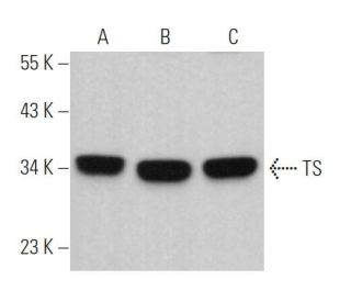 TS Antibody (D-2) - Western Blotting - Image 363492