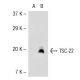TSC-22 Antibody (R5-6) - Western Blotting - Image 54129