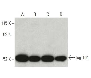tsg 101 Antibody (51) - Western Blotting - Image 397510 