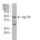 tsg 101 Antibody (Y16J) - Western Blotting - Image 34613 
