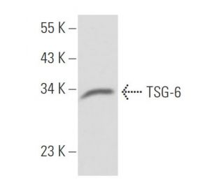 TSG-6 Antibody (A38.1.20) - Western Blotting - Image 18053