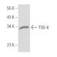 TSG-6 Antibody (A38.1.20) - Western Blotting - Image 18053
