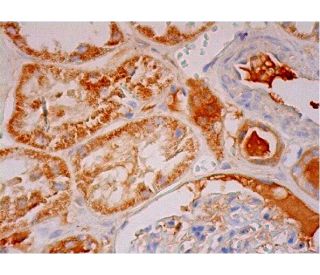 TSG-6 Antibody (E-1) - Immunohistochemistry - Image 293396 