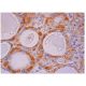 TSHR Antibody (2C11) - Immunohistochemistry - Image 284775