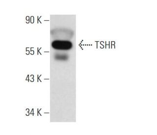 TSHR Antibody (A10) - Western Blotting - Image 14653 
