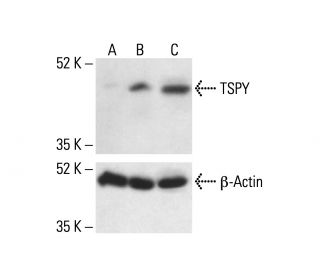 TSPY Antibody (SF-2) - Western Blotting - Image 412051 