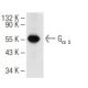 Gα s (K-20): sc-823. Western blot analysis of Gα s expression in TT whole cell lysate.