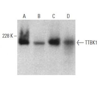 TTBK1 Antibody (B-6) - Western Blotting - Image 396103 