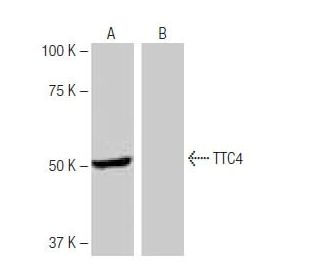TTC4 Antibody (TR-L6) - Western Blotting - Image 65084