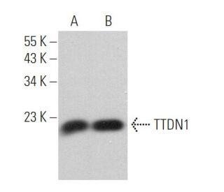 TTDN1 Antibody (F-8) - Western Blotting - Image 371258 