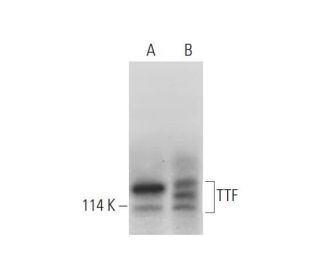 TTF/Transcription Termination Factor/TTF1 Antibody (A-5) - Western Blotting - Image 312013