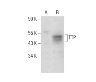 TTP Antibody (H-12) - Western Blotting - Image 309529 