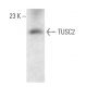TUSC2 Antibody (1550CT388.74.12) - Western Blotting - Image 374605