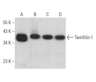 Twinfilin-1 Antibody (B-7) - Western Blotting - Image 366279 