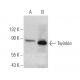 Twinkle Antibody (1C5) - Western Blotting - Image 374541 