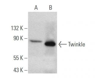 Twinkle Antibody (1C5) - Western Blotting - Image 374541Each CRISPR/Cas9 Knockout (KO) Plasmid product consists of a pool of 3 plasmids designed to ensure identification and cleavage of a specific gene for maximum knockout efficiency. Each plasmid encodes a unique 20 nt sequence derived from the GeCKO (v2) library.