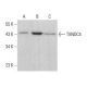 TXNDC4 Antibody (H-11) - Western Blotting - Image 376322