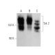 Tyk 2 Antibody (H-4) - Western Blotting - Image 360075